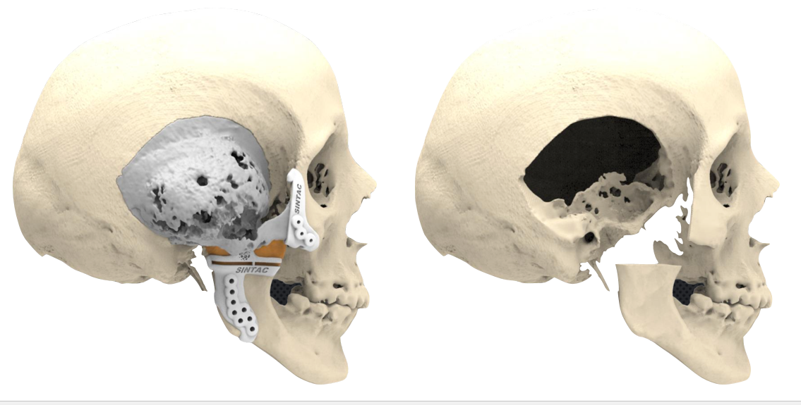 SnapCrab NoName 2018 2 9 22 57 33 No 00